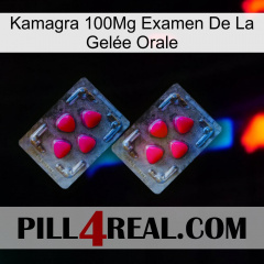 Kamagra 100Mg Examen De La Gelée Orale 14